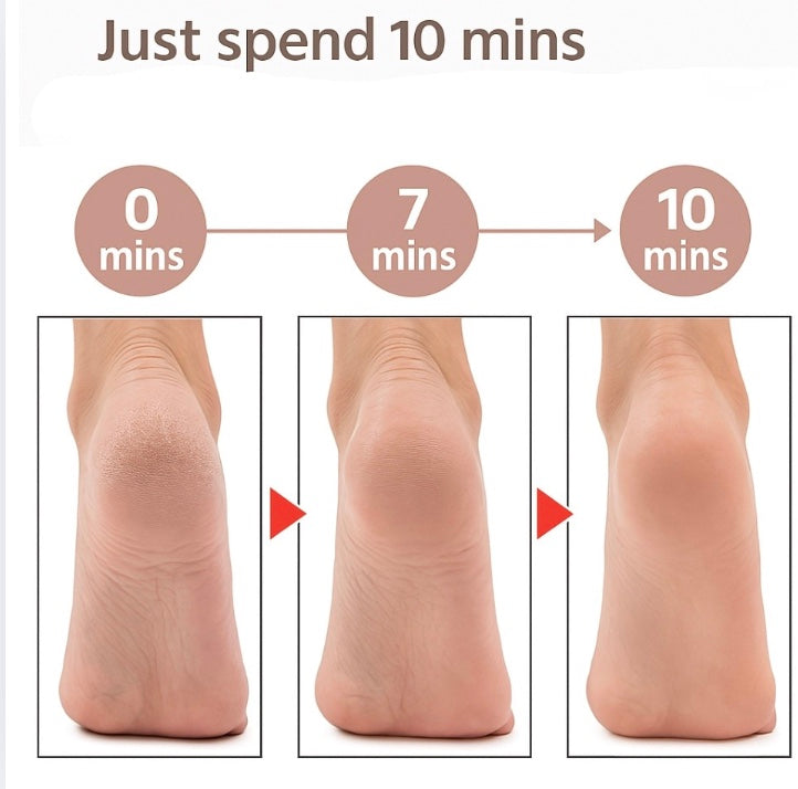 SmoothStep™ + FREE Replacement Rollers